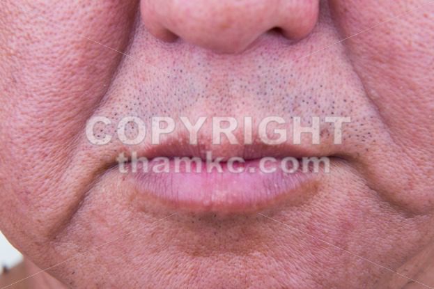 Closeup on saggy cheek skin of matured Asian man - ThamKC Royalty-Free Photos